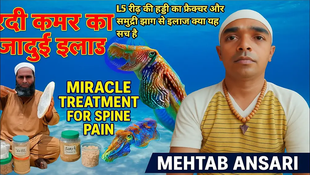 Video thumbnail of 🎬 👉 L5 रीढ़ की हड्डी में फ्रैक्चर – क्या समुद्री झाग से इलाज सच है? सच जानिए SCI Group Mehtab Ansari